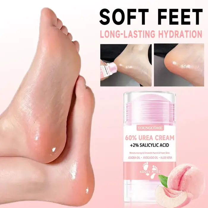 Crème à 60% d'urée + 2% d'acide salicylique pour les pieds et les mains, anti-dessèchement, élimination des peaux mortes, hydratante, parfumée, élimine les odeurs de pieds