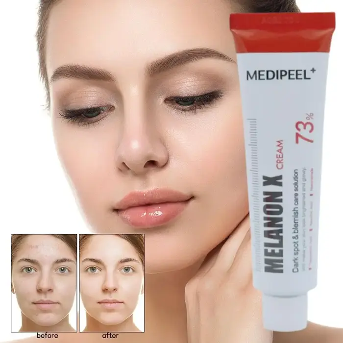 Crème anti-acné hydratante 30ml