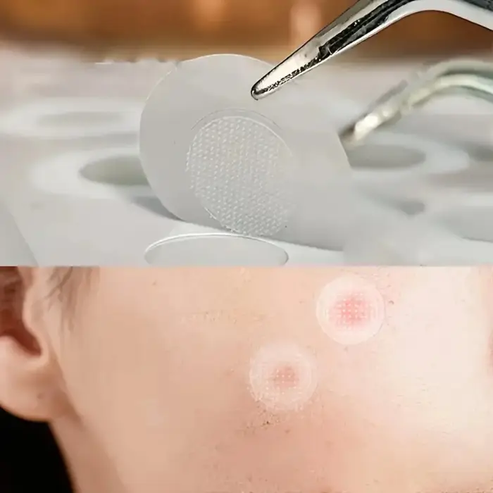 Autocollants hydrocolloïdes contre l'acné