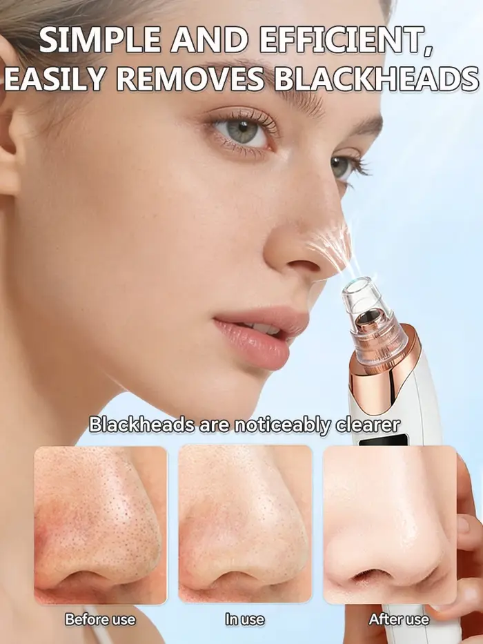 Masque anti-points noirs et anti-imperfections - Aspirateur de pores - Éliminateur de points