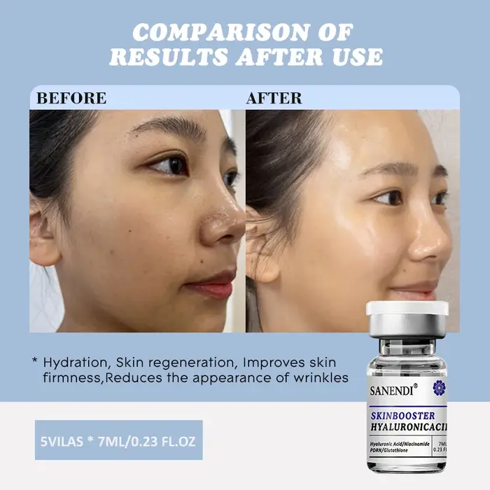 Gel de soin pour la peau à l'acide hyaluronique PDRN, 7ML, avec Niacinamide, pour stylo Derma, verro