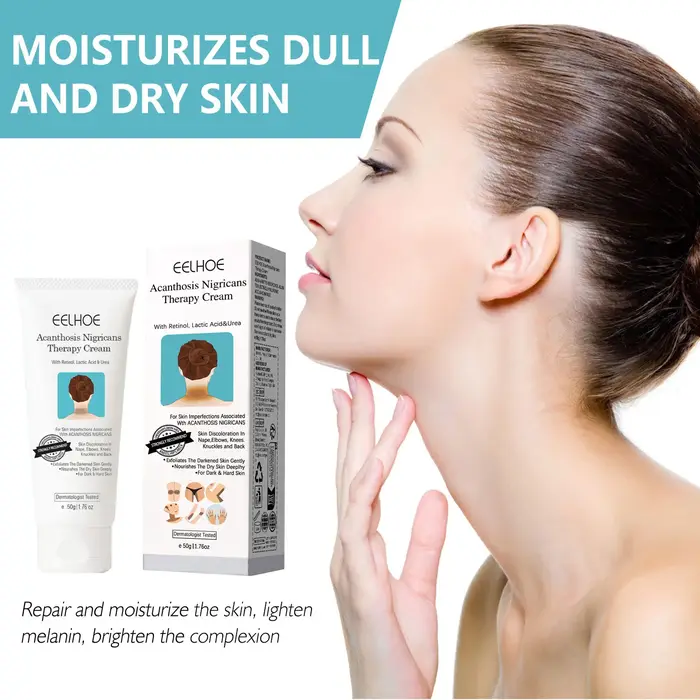 EELHOE acanthose Nigricans thérapie crème cou bras genou articulation aisselles éclaircissant produits de soins du corps