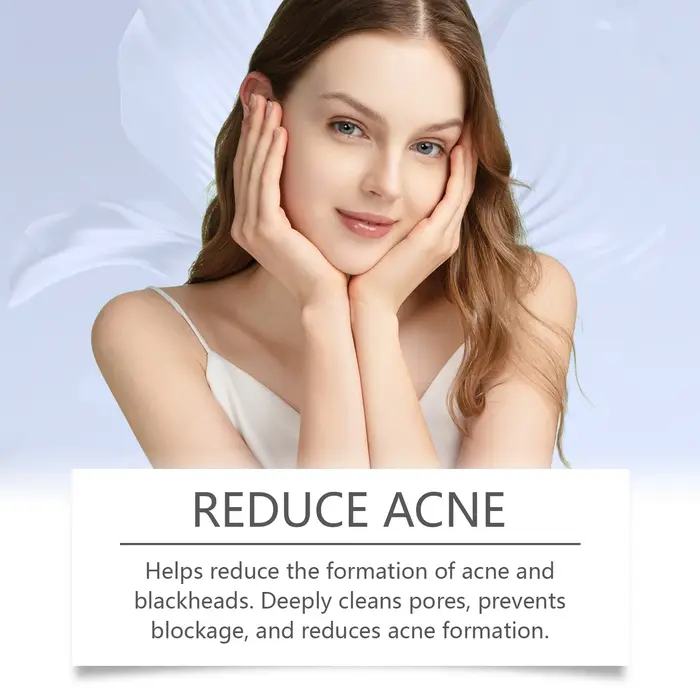 Crème Anti-acné 20/40/60g