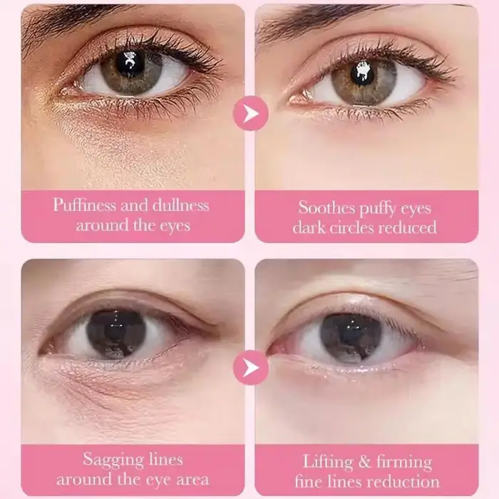 Patchs pour les yeux au collagène multi-peptides pour les yeux gonflés