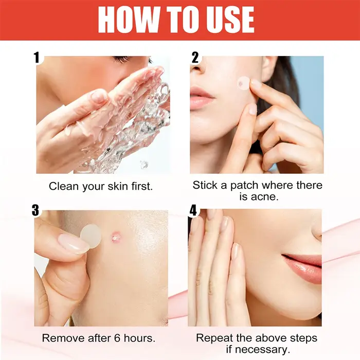 Lot de 144 patchs invisibles professionnels pour le soin de la peau du visage