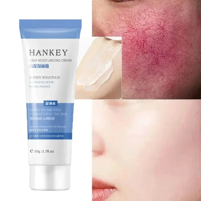 Crème réparatrice pour les rougeurs du visage, améliore la sécheresse de la peau sensible, hydratant